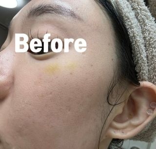 바노바기 코스메틱 알파 래디언스 세럼 30ml — 5점을 준 리뷰어가 2023년 11월 올린 사용 사진