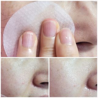 산다화 비타민씨 화이트닝 토너 패드 — 5점을 준 리뷰어가 2023년 9월 올린 사용 사진