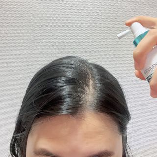 모두발라 탈모집중케어 헤어토닉 — 5점을 준 리뷰어가 2021년 12월 올린 사용 사진