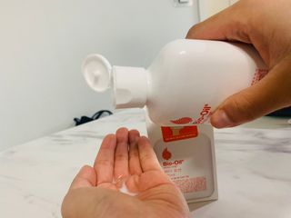 바이오오일 [바이오-오일] 바디 로션 175ml — 4.5점을 준 리뷰어가 2021년 10월 올린 사용 사진