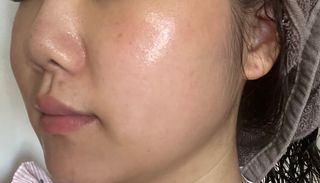 베지톨로지 비니페린 브라이트닝 앰플 — 5점을 준 리뷰어가 2022년 7월 올린 사용 사진