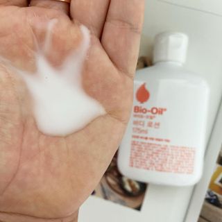 바이오오일 [바이오-오일] 바디 로션 175ml — 5점을 준 리뷰어가 2021년 9월 올린 사용 사진