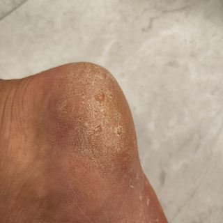 짱채맘님이 올린 리뷰 사진 4