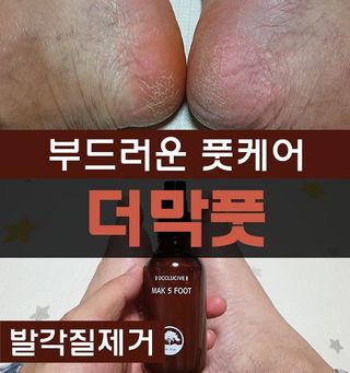 미니러브님이 올린 리뷰 사진 1