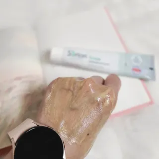 건선/아토/습진/민감성 피부 천연보습진정크림 소리온 크림 & 센시티브 크림 50g — 5점을 준 리뷰어가 2022년 1월 올린 사용 사진