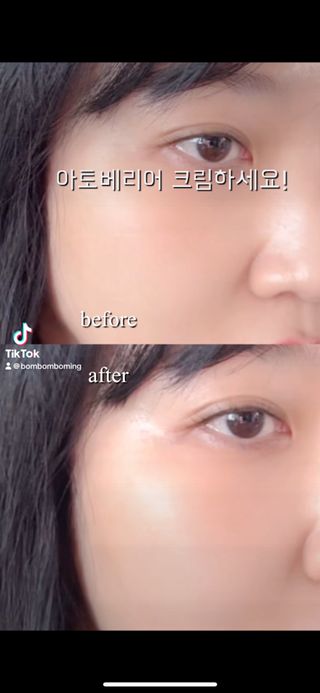 틱톡 캠페인 ★ ｜ Tiktok x 0.8L 에스트라리제덤 2차 크림 (최종) — 5점을 준 리뷰어가 2024년 11월 올린 사용 사진