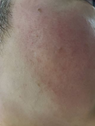 [NEW_버진팜스 푸딩수딩] 투명 푸딩젤이 선사하는 빠른 진정과 깨끗한 피부결 정돈 — 5점을 준 리뷰어가 2021년 10월 올린 사용 사진