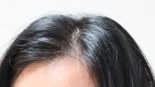나노힐 아미노 샴푸 300ml — 5점을 준 리뷰어가 2023년 4월 올린 사용 사진