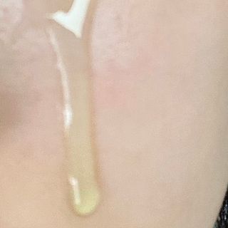 *✅프리 (블로그체험단) [밀리밀리] 메디 앰플 시카 15ml — 5점을 준 리뷰어가 2025년 9월 올린 사용 사진