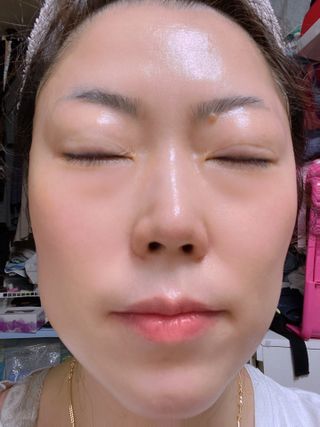 나나스킨 콤플렉스씨쓰리닥터클리어앰플 — 5점을 준 리뷰어가 2021년 5월 올린 사용 사진