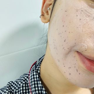 프롬노시베 로지 클레이 버블 팩 — 5점을 준 리뷰어가 2022년 1월 올린 사용 사진