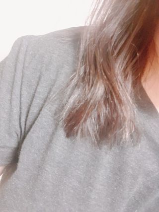 썸헤어 / SUMHAIR 썸헤어 헤어링 앰플 2종 중 택1 — 5점을 준 리뷰어가 2021년 4월 올린 사용 사진