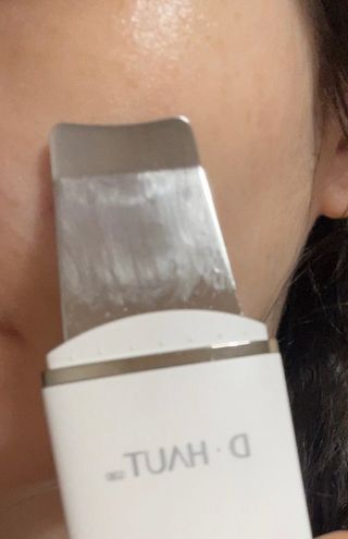 디하우트 랩 4 in 1 갈바닉 아쿠아 워터 필링기 스킨스크러버 — 5점을 준 리뷰어가 2021년 11월 올린 사용 사진