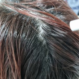 모두발라 탈모집중케어 헤어토닉 — 4점을 준 리뷰어가 2021년 12월 올린 사용 사진