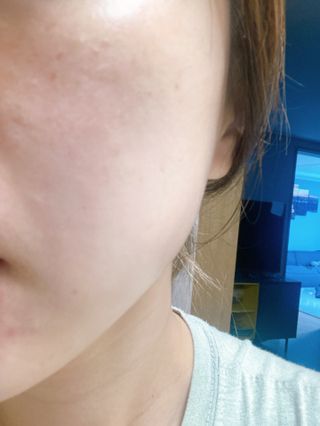 약손명가코스메틱 에오스보떼 블라인드 비비크림 50ml — 4.5점을 준 리뷰어가 2021년 9월 올린 사용 사진