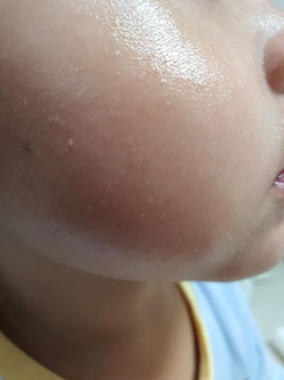 유세린 아쿠아퍼 리페어링 오인트먼트 1개 + 아쿠아퍼 SOS 립 리페어 1개 — 5점을 준 리뷰어가 2022년 2월 올린 사용 사진