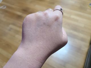 메디필 레드 락토 콜라겐 필링패드 — 5점을 준 리뷰어가 2021년 3월 올린 사용 사진