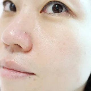 듀오코리아 [듀오] 피부맞춤형 저자극 클렌징밤 1종 랜덤발송 (모공케어,안색개선,안티에이징,블랙헤드) — 5점을 준 리뷰어가 2022년 4월 올린 사용 사진