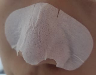 세뚜아(Cettua) 세뚜아 스티키 포어 패치 Cettua Sticky Pore Patch — 5점을 준 리뷰어가 2023년 9월 올린 사용 사진