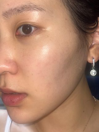 로우퀘스트 베리어 인핸싱 토너투에센스 200ml — 5점을 준 리뷰어가 2023년 10월 올린 사용 사진