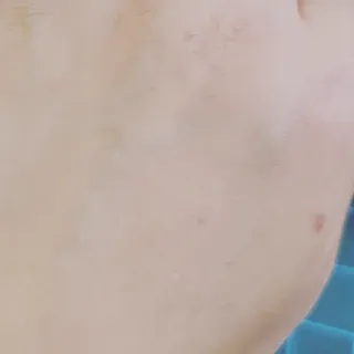 [후르디아] 민감피부 수분크림 비건 아보카도 크림 — 5점을 준 리뷰어가 2022년 9월 올린 사용 사진