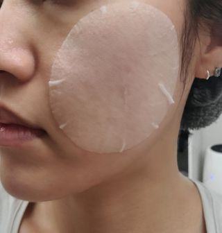 랑벨 랑바이오 블랙 시카 퀵 패드 100매 (3초 쿨링/3분 흡수, 블랙비 프로폴리스/시카 4종 함유, 대용량) — 5점을 준 리뷰어가 2022년 5월 올린 사용 사진