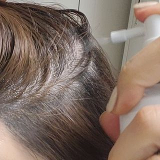 모두발라 탈모집중케어 헤어토닉 — 4점을 준 리뷰어가 2022년 1월 올린 사용 사진