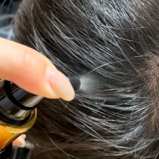 썸헤어 / SUMHAIR 썸헤어 써밋 안티 헤어로스 토닉 — 4.5점을 준 리뷰어가 2021년 5월 올린 사용 사진