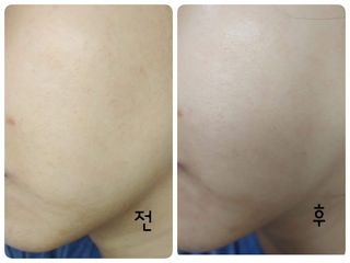 투비어레이디 젤리팩 25g /6종 중 랜덤3종 발송/ 도구가 필요없는 피부관리끝판왕 모델링팩 — 4.5점을 준 리뷰어가 2021년 3월 올린 사용 사진