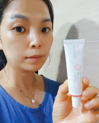 작심연구소 바르는 피부과 레이저 메디스팟크림 플러스 — 5점을 준 리뷰어가 2022년 6월 올린 사용 사진