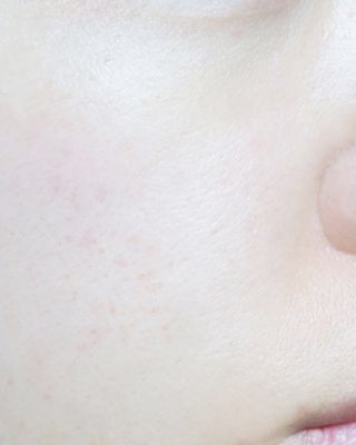 셀라피 에이리페어 오리지널 크림 2세대 50ml — 5점을 준 리뷰어가 2021년 1월 올린 사용 사진