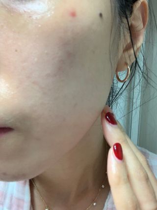 바이오오일 [바이오-오일] 스킨케어 오일 내추럴 60ml — 5점을 준 리뷰어가 2021년 5월 올린 사용 사진