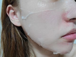 세뚜아(Cettua) 세뚜아 스티키 포어 패치 Cettua Sticky Pore Patch — 5점을 준 리뷰어가 2023년 8월 올린 사용 사진