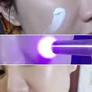 메데스 비츠케어 모공케어 피부관리키트 — 5점을 준 리뷰어가 2021년 8월 올린 사용 사진