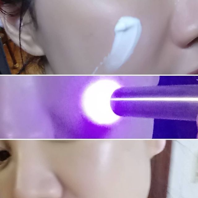 비츠케어 모공케어 피부관리키트 리뷰 사진