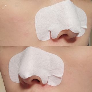 세뚜아(Cettua) 세뚜아 스티키 포어 패치 Cettua Sticky Pore Patch — 5점을 준 리뷰어가 2023년 9월 올린 사용 사진
