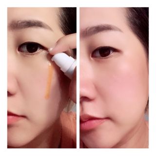 유니베르소 로즈힙 오일 15ml — 5점을 준 리뷰어가 2021년 7월 올린 사용 사진