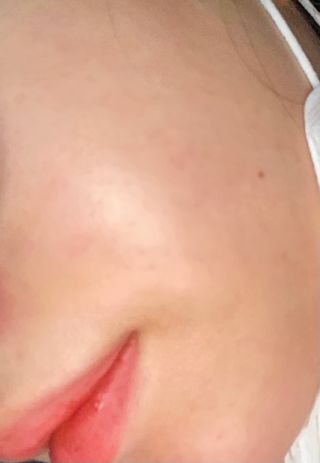 닥터펩티 펩텔라 시카웃 앰플 — 5점을 준 리뷰어가 2021년 1월 올린 사용 사진