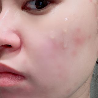 에센느 닥터 멜라닌 화이트닝 앰플 — 4.5점을 준 리뷰어가 2023년 4월 올린 사용 사진