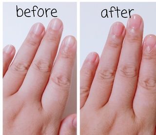 젤리핏 피치리페어 10ml 피치 컬러영양제 효과있는 손톱강화제 — 5점을 준 리뷰어가 2022년 7월 올린 사용 사진