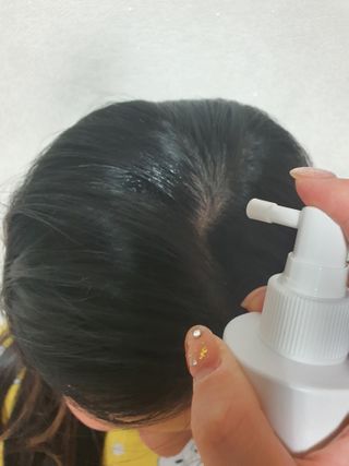 리더스코스메틱 리더스 헤어 라피 헤어 로스 컨트롤 토닉 — 5점을 준 리뷰어가 2021년 1월 올린 사용 사진