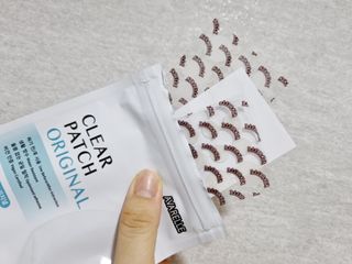 에버렐 아크네 클리어 패치 오리지널(40매) + XL(8매) 1세트, 각 1개씩 — 5점을 준 리뷰어가 2022년 5월 올린 사용 사진