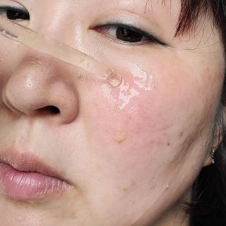 에센느 닥터 멜라닌 화이트닝 앰플 — 5점을 준 리뷰어가 2023년 5월 올린 사용 사진