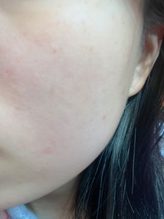 오투에니원 갈락토미세스 비타민 C 더블 브라이트닝 세럼 50ml — 5점을 준 리뷰어가 2023년 2월 올린 사용 사진