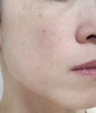 스킨1004 [SKIN1004] 마다가스카르 센텔라 앰플 폼 125ml — 5점을 준 리뷰어가 2024년 8월 올린 사용 사진