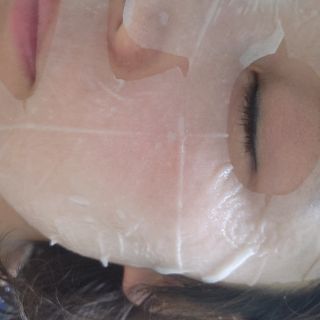 세뚜아(Cettua) 세뚜아 스팟 클리어 듀얼 패치 Cettua Spot Clear Dual Patch — 5점을 준 리뷰어가 2023년 7월 올린 사용 사진