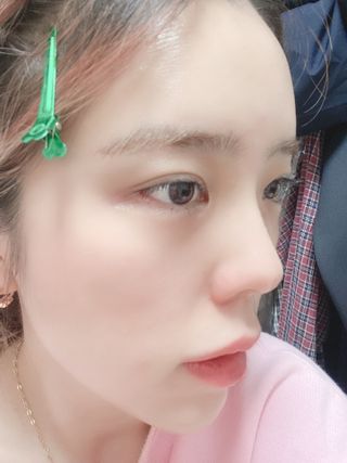 셀바이져 지우개 미스트 피부 보호 입주변 트러블 진정 케어 아기 안개분사 미스트 — 5점을 준 리뷰어가 2021년 3월 올린 사용 사진