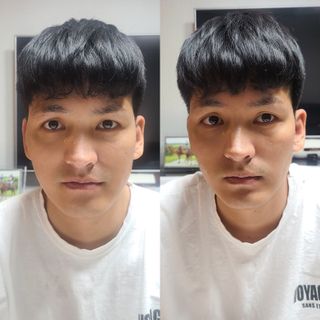 아이디플라코스메틱 아이디 페이스핏 마이너스 밴드 v2 — 5점을 준 리뷰어가 2021년 5월 올린 사용 사진