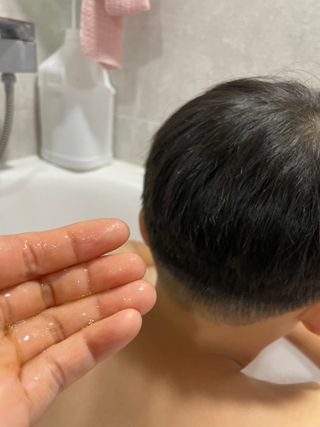 세렌닥터 스칼프 루트 케어 샴푸 — 5점을 준 리뷰어가 2022년 11월 올린 사용 사진