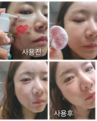 스킨1004 [SKIN1004] 마다가스카르 센텔라 라이트 클렌징 오일 200ml — 5점을 준 리뷰어가 2024년 7월 올린 사용 사진